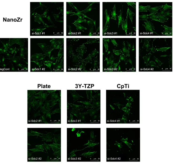 Figure 4. Organization of actin stress fibers and focal adhesion of MC3T3-E1 cells cultured on  different material surfaces after 48h RNA interference treatment