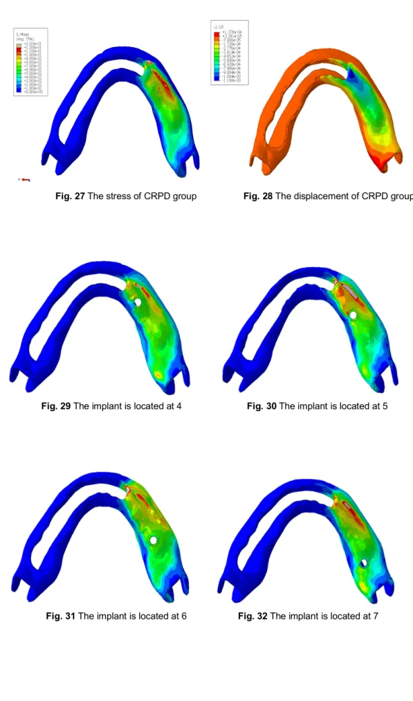 Fig. 27 The stress of CRPD group                    Fig. 28 The displacement of CRPD group 