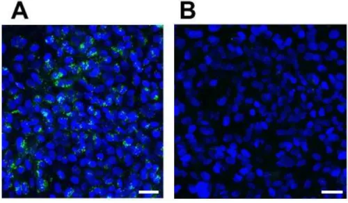 Figure  2-3.  Exosomes  are  internalized  into  hCMEC/D3  cells  in  an  energy-dependent manner