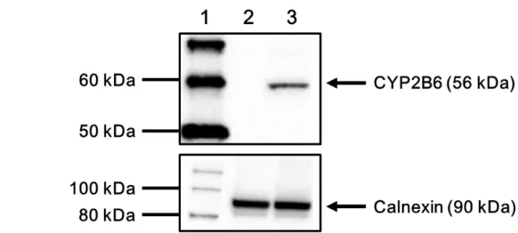 Fig.  5.  Western  blots  showing  immunoreactive  CYP2B6  protein  (upper  panel)  and  calnexin  (lower  panel)