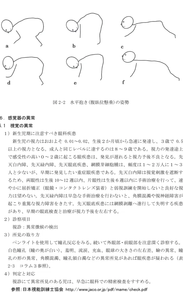 図 2-2  水平抱き(腹臥位懸垂)の姿勢  ６．感覚器の異常  6.1  視覚の異常  １）新生児期に注意すべき眼科疾患  新生児の視力はおおよそ 0.01～0.02、生後２か月頃から急速に発達し、３歳で 0.5 以上の視力となる。成人と同じレベルに達するのは８～９歳である。視力の発達途上 で感受性の高い０～２歳に起こる眼疾患は、発見が遅れると視力予後不良となる。先 天白内障、先天緑内障、先天眼底疾患、網膜芽細胞腫は、頻度は１～２万人に１～３ 人と少ないが、早期に発見したい重症眼疾患である。先天白内障は視