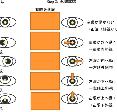 図 2-4  眼位検査（左眼斜視の検出）  6.2  聴覚の異常  １）所見の取り方  保護者から「聞こえていない」という不安の訴えがあった場合に、「聴覚発達チェッ クリスト」(表 2-7)をつけてもらう。  ２）判定と対応  傍から観察できる聴性行動は生後４か月前後に一時的に鈍くなり、周囲からみて「聞 こえていない」ようにみえる。このためこの時期に難聴に対する不安を訴える保護者 は多い（図 2-5）。  「聴覚発達チェックリスト」を生後４か月以降につけると、Moro 反射などの原始反 射を評価する０か月か