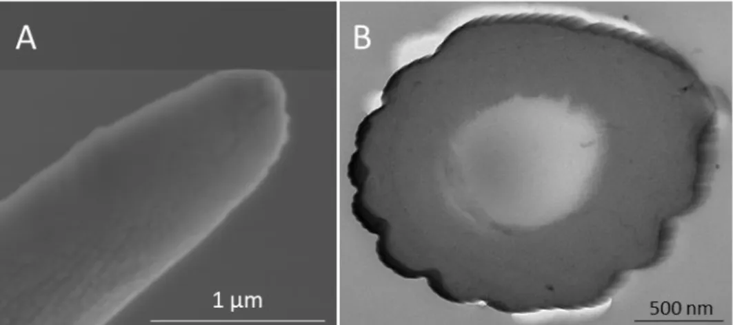図 11：オオニジュウヤホシテントウの跗節上の感覚子の外部形態および内部形態 