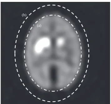 Fig. 2 Attenuation correction range of Chang method. (a) The outline was determined by setting a threshold