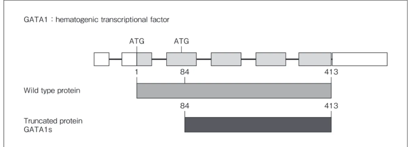 Fig. 2　 GATA1 gene mutation of Down syndrome.GATA1：hematogenic transcriptional factor