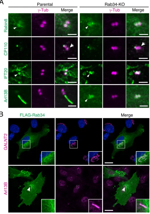 FIGURE 8.  Rab34 is required for early steps in serum-starvation-induced ciliogenesis in hTERT-RPE1 cells