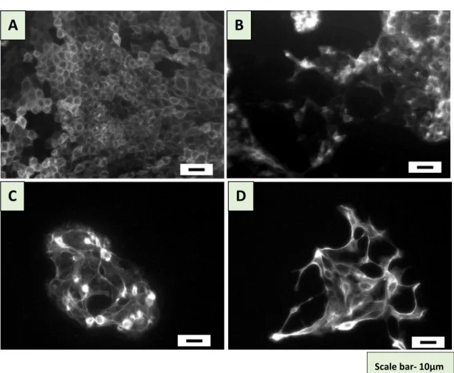 Figure 16: Shows the growth of MDCK cells with commercially available implants  (A) Control (B) SK-5M (C) SUY-1 (D) SUS-304