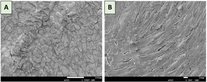 Figure 17: SEM analysis of C2C12 cells on the surface of UHP-iron.  