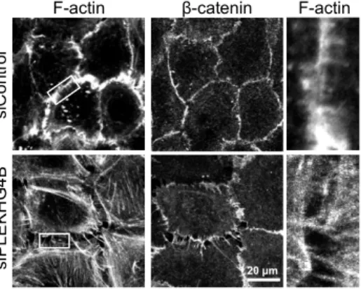 Figure 1. Effects of PLEKHG4B knockdown on  cell-cell adhesion in A549 cells. Control cells (top)  and PLEKHG4B knockdown cells (bottom) were  stained for actin cytoskeleton and β-catenin (AJ)