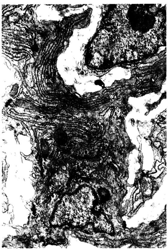 図 1 6 図 7と同 じ箇 所 の中膜 最 外 層 . これ らの細 胞 は筋細 糸 を欠 き, 層 状 に 良 く発 達 した粗 面 小胞 体 , 大 きな ゴル ジ装 置 を有 し一 見 線維 芽 細 胞 様 で あ るが, 互 い に広 い接 触 面 を もって密接 し, 平 滑 筋 細 胞 様 に層 状 に配 列 して い る