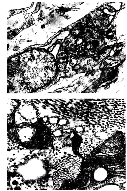 図 1 7 図 7と同 じ箇所 の外膜 に見 られた未分化間葉性細胞,外側核膜か ら粗面小胞体が発達 しつつあ る. ( 矢 印) ウラン,鉛二重染色 ×2 6, 0 0 0 .