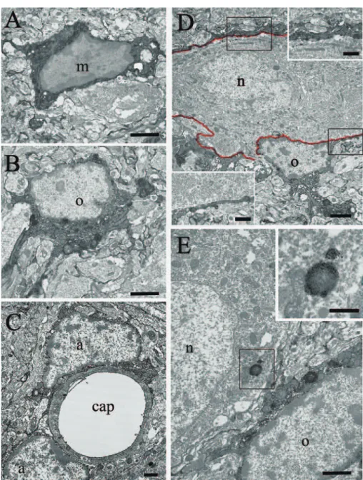 Fig. 3 Electron micrographs of the parvocellular part of the HPV treated by the section-Perls methods with DAB-silver- Fig. 3 Electron micrographs of the parvocellular part of the HPV treated by the section-Perls methods with DAB-silver-gold intensiﬁ catio