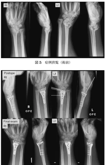 図 5  症例供覧（術前）