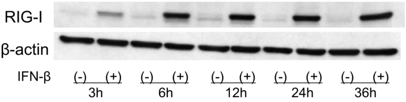 Fig. 3　IFN-β 誘導性 RIG-I タンパクの経時的変化