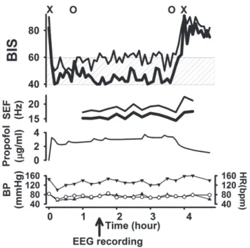 Fig. 2　Changes in bispectral index （BIS） and 95% spectral edge frequency （SEF） effect-site concentration of  propofol and hemodynamics.