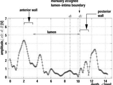 Fig. 4. (a) Displacement at each depth at beam position  1 measured by the phased-tracking method