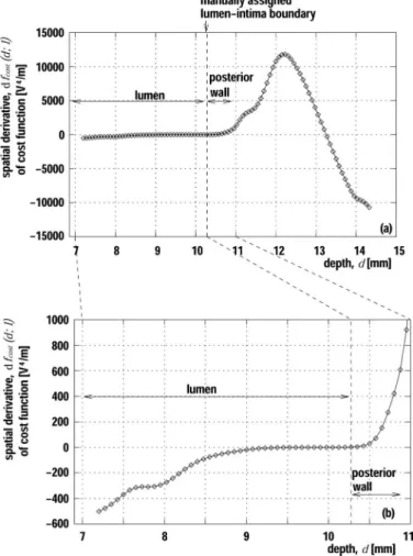 Fig. 7. (a) Manually determined lumen-intima boundary (50-year-old male). (b) Lumen-intima boundary detected by setting the threshold level to the amplitude, | z(t; d; ) | , of the quadrature demodulated signal.