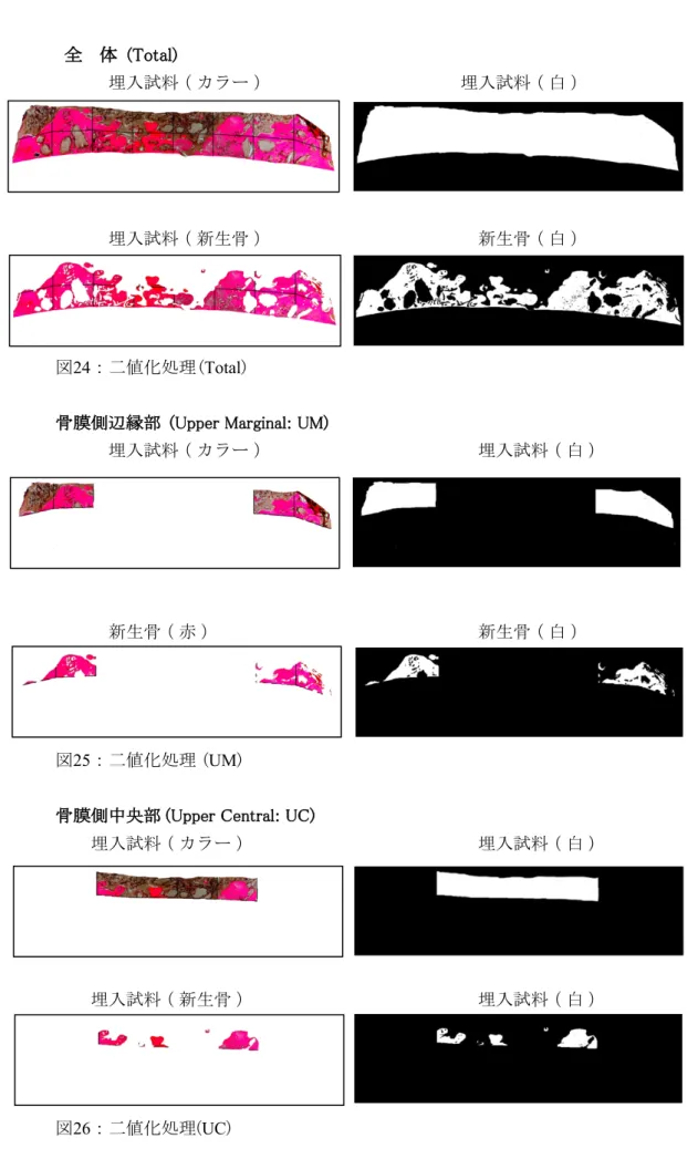 図 25 ： 二値化処理 ( UM )