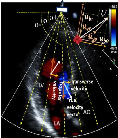 Figure 3.5: Apical three-chamber (A3C) view of the EDG method estimates the component of flow velocity in a perpendicular direction