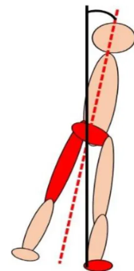 図 6.7  想定される麻痺側上部セグメントの異常運動による非麻痺側への影響  この図では，左側が麻痺側であり，赤の部分（麻痺側大腿部・骨盤）で異常が発生した結