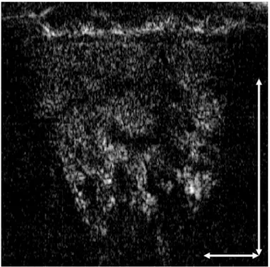 図 3.4 Image J  にインポートされた B モード画像.  矢印: 1 mm.