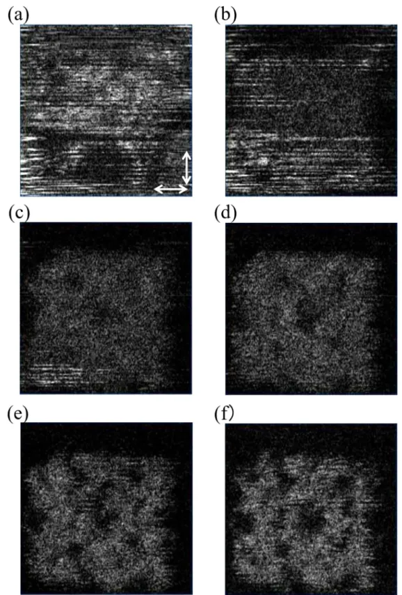 図 3.13  頬の MPR 画像  (21 歳男性).  (a)  表面. (b) 100 µm. (c) 200 µm. (d) 300  µm. (e) 400 µm