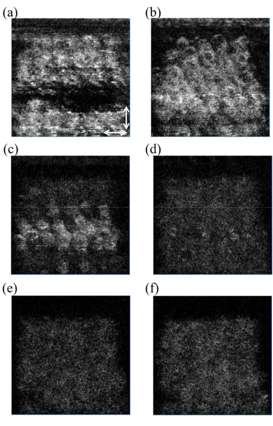 図 3.18  前腕の MPR 画像   (24 歳男性 ). (a)  表面 . (b) 100 µm. (c) 200 µm. (d) 300  µm. (e) 400 µm