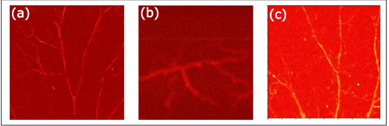 Figure 1.3: The raw images of PA imaging. (a) In vivo mice ear, (b) in vivo mice brain, (c) in vivo mice at different position with image (a), the raw images of PA imaging are low contrast and contaminated by noise.
