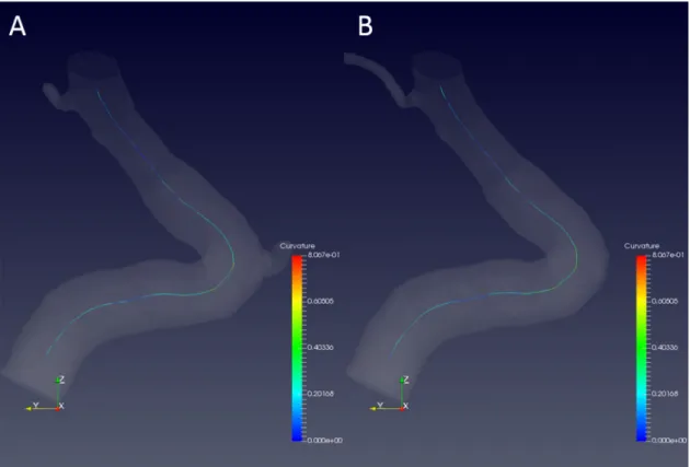 Fig 2.15: A and B, centerline analysis of a threshold-based segmentation model (A) and a gradient-based  segmentation model (B)