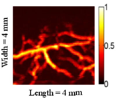 Figure 3.9: Filtered MAP image of mouse brain vessels.