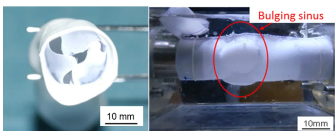 Fig. 1.9 Conduit 型に成型された ePTFE 製肺動脈代用弁付導管