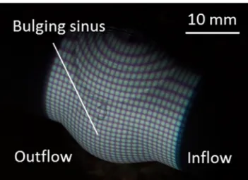 Fig. 3.4 ePTFE 導管 bulging sinus 上に投影した格子状模様