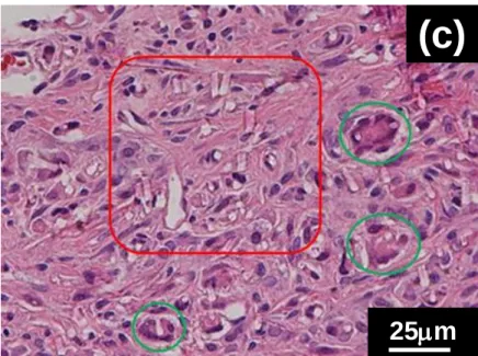 図 4-2(c)  直径 13µm の B- ガラス繊維塊埋入後 4 週間の組織        (c) の赤四角内にガラス繊維、緑円内に異物巨細胞が認められる。