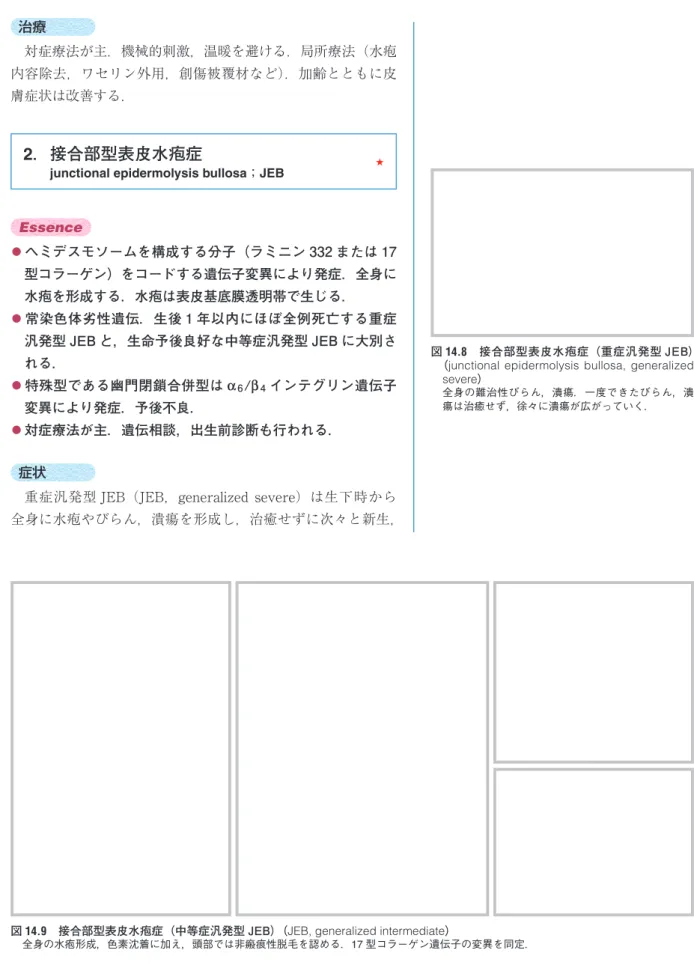 図 14.9　接合部型表皮水疱症（中等症汎発型 JEB）（JEB, generalized intermediate）