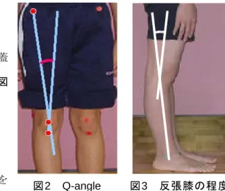 図 4 膝蓋骨の方向