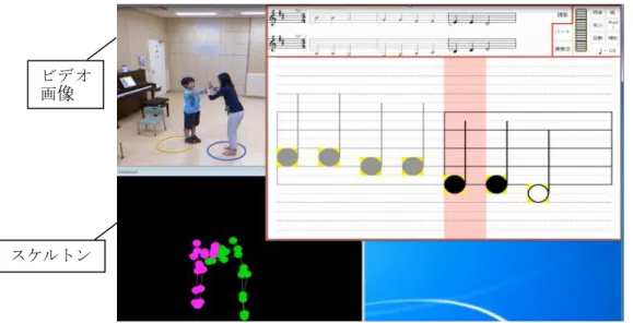 図 3-6  Cymis  ＆  Kinect（ハイタッチプログラム）を演奏する ASD 児 
