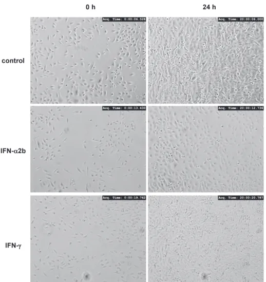 Fig. 5　Effects  of  IFNs  on  cell  proliferation  in  HSC-3  cells.  HSC-3  cells  were  grown  with  IFN- α 2b  or  IFN- γ   for  24 h,  and  then  those  images  were  captured  under  a  phase-contrast  microscopy