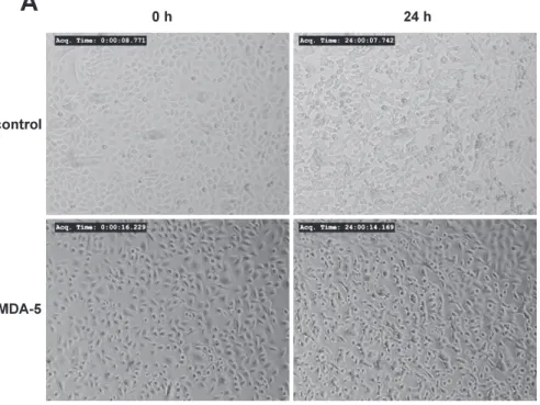 Fig. 6　Effects of MDA-5 overexpression on cell proliferation in HSC-3 cells. HSC-3 cells were transfected with plasmid vec- vec-tor encoding MDA-5 cDNA or control expression vecvec-tor, then the cells were photographed under the phase-contrast  micros-copy