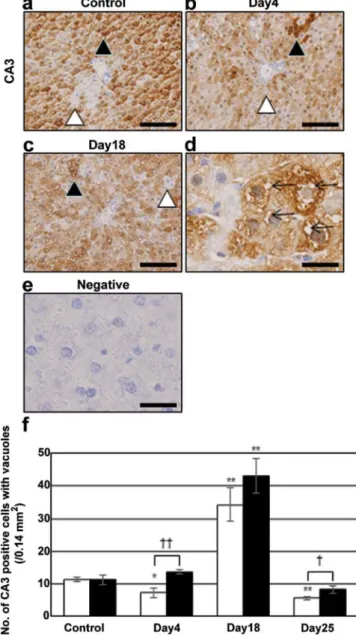 Figure 3. (a-d) Immunostaining for Fasn, and (e-g) cytokeratin 19 in  (a and e) control and irinotecan group (b, d, f and g) on day 4, and the number  of (h) Fasn-strongly-positive hepatocytes