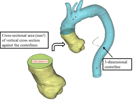 Figure 3: Assessment of aortic size. 