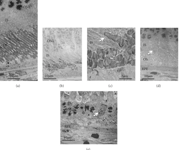Figure 3: The electron microscopic findings of SD and S334ter rats. (a) An SD rat on P69
