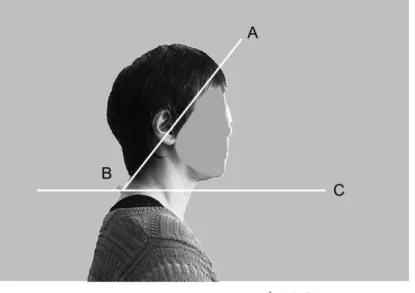 図 4   Forward head posture の計測方法 