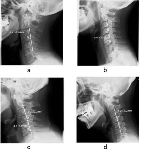 図 11 ： CCSA 