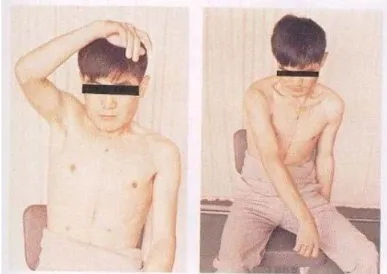 図  2-14  Flexor and Extensor Synergy Movement Pattern 