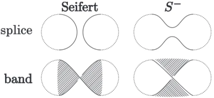 図 3: バンドの付け替え . 斜線部分 (band) に注目する . 左図では splice に対し２つの component を連結する half-twisted band をつけていて , 右図では紙面に対して手前か 奥行きに向かって円環をなすように half-twisted band をつけている