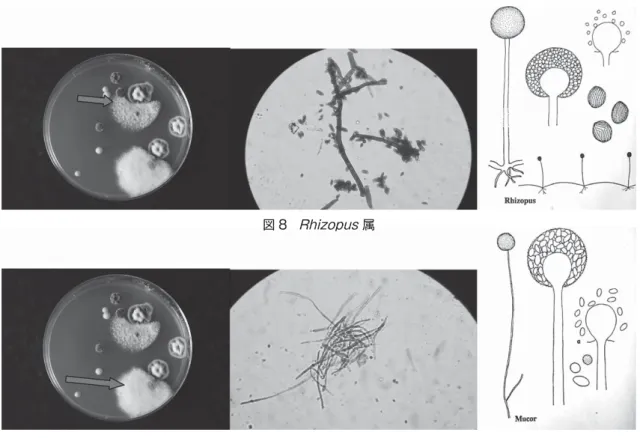 図 8  Rhizopus 属図 8 Rhizopus属 図 9  Mucor 属 イトが形成される。通常、土壌、植物屑、家 の内部の塵埃から分離される）；図 7 参照 （ 6 ） Rhizopus 属（俗にクモノスカビと呼ばれる。 コロニーはきわめ速やかに成長し、暗色〜淡 色の胞子と大型の柱軸を含む胞子のうが特 徴。腐敗した果実、土壌、室内塵埃上に普通 見いだせる）；図 8 参照 （ 7 ） Mucor 属（俗にケカビと呼ばれる。コロニー は速やかに育ち、白色〜灰色、通常多数の上 向きの胞子のう柄を生じる