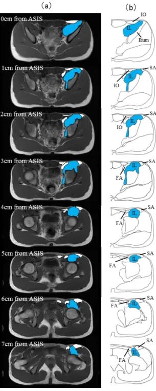 図 2.1  代表的 MRI 横断画像および各画像のスケッチ画 