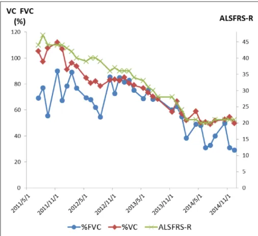 Fig. 2 An example of the bulbar paraly - -sis type ALS showing that the VC meas  -urement is useful (Case B–2)