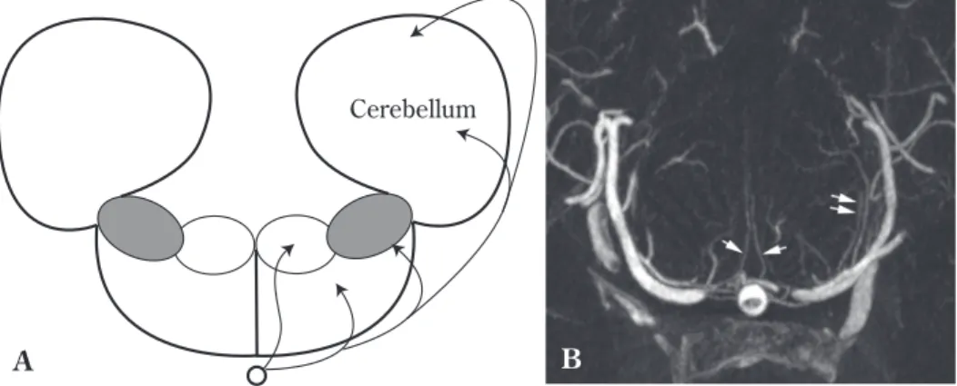 Fig.   7  Basic arterial angioarchitectures of the brain stem