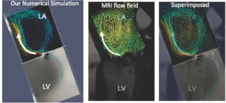 Figure 16: Qualitative comparison between our simulation of flow in the mock left atrium